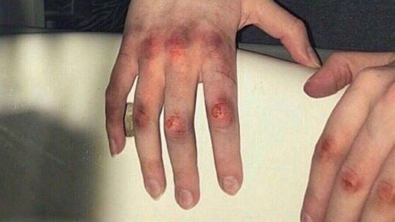 Волинь: судили дівчину, яка побила неповнолітню