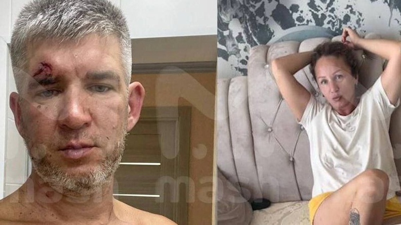 Кримчанка побила свого чоловіка пательнею, який підтримував війну в Україні