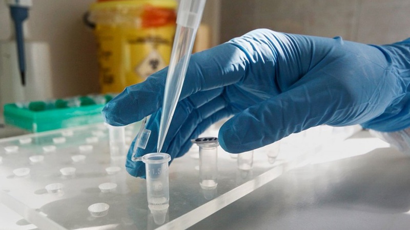 Тест на нейтралізуючий білок допоможе визначитися, чи варто вакцинуватися, – луцька лікарка