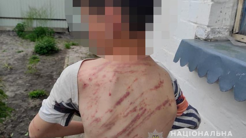 На Волині чоловік жорстоко «виховував» пасинка різкою