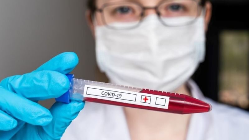 За добу в Україні підтвердили 484 нові випадки COVID-19