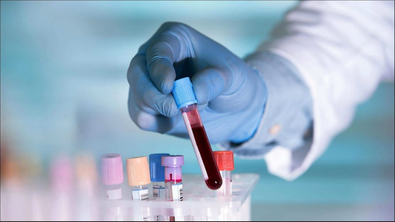 На Волині за добу підтвердили один випадок COVID-19