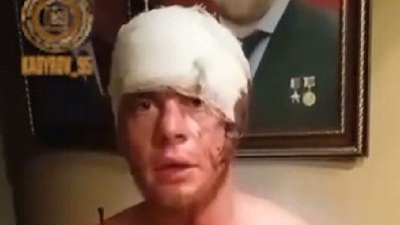 Полонений боєць ЗСУ сказав окупанту, що він патріот