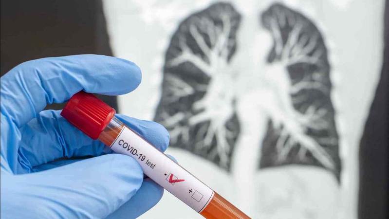 Де на Волині виявили 91 нового хворого на COVID-19