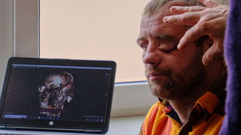 На Волині хірурги з Канади допомогли прооперувати п’ятьох воїнів