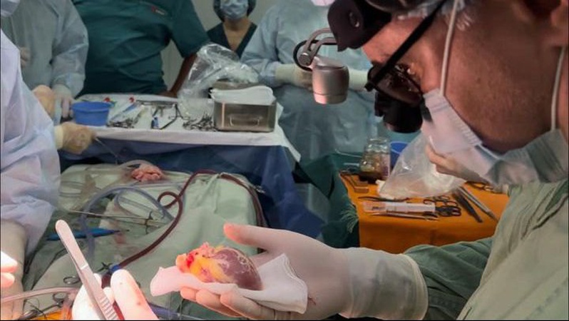 Ексзаступник міністра мав спільників у Волинській обласній лікарні, які незаконно вилучали органи