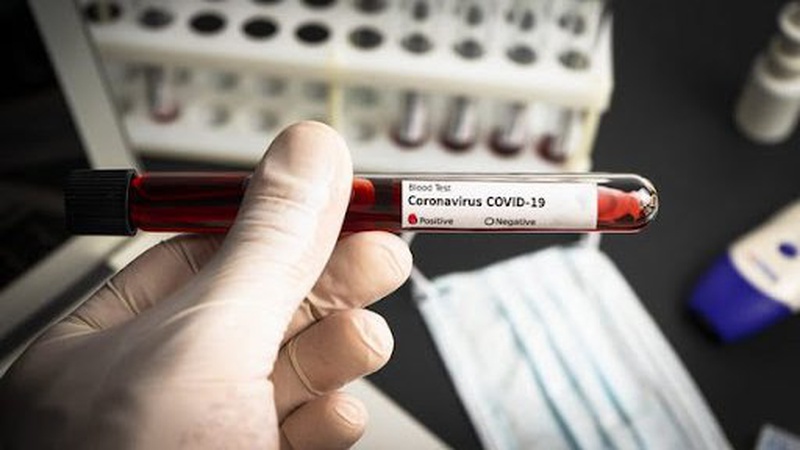 В Україні за добу виявили 20 791 новий випадок COVID-19