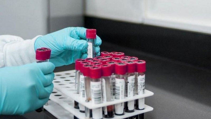 На Волині 170 людей захворіли на коронавірус