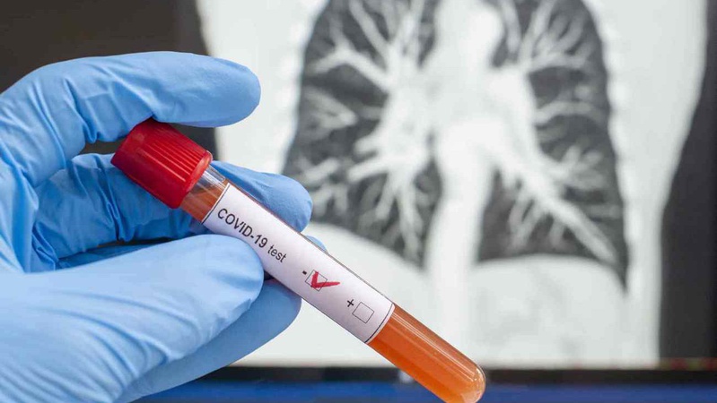 За добу на Волині підтвердили 144 нових випадків COVID-19, дев’ять – летальних