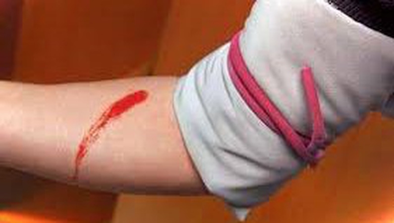 Луцькі патрульні врятували жінку, яка порізала собі вени