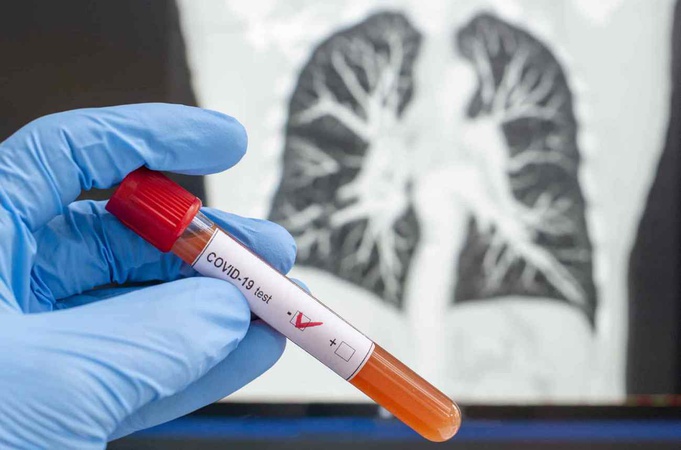 Скільки волинян із коронавірусом у реанімаціях і на ШВЛ