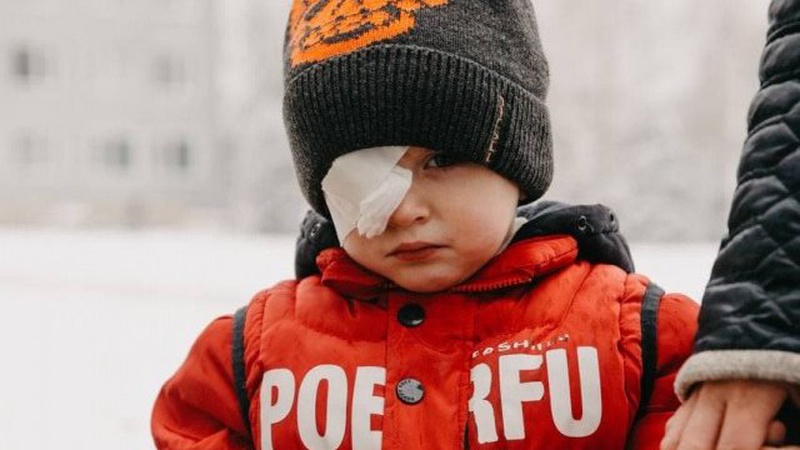 Збирають кошти на операцію маленькому волинянину, який може втратити око через нещасний випадок