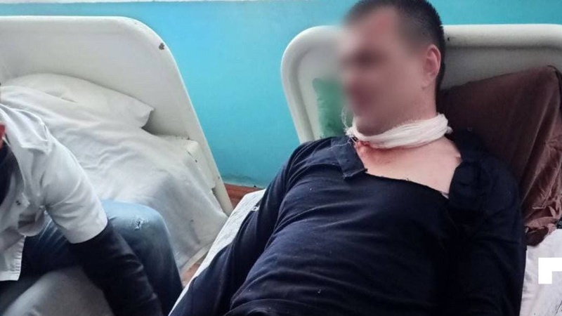 У Луцьку чоловік порізав собі обличчя лезом