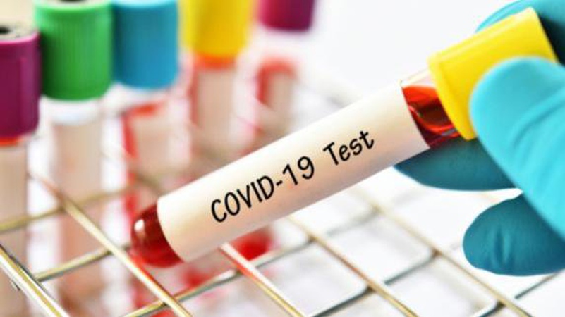 В Україні за добу виявили 7 117 нових хворих на ковід, на Волині – 94