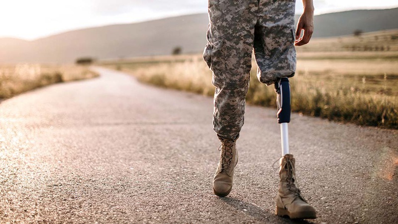 Військовим спростять отримання виплати на протезування: що зміниться