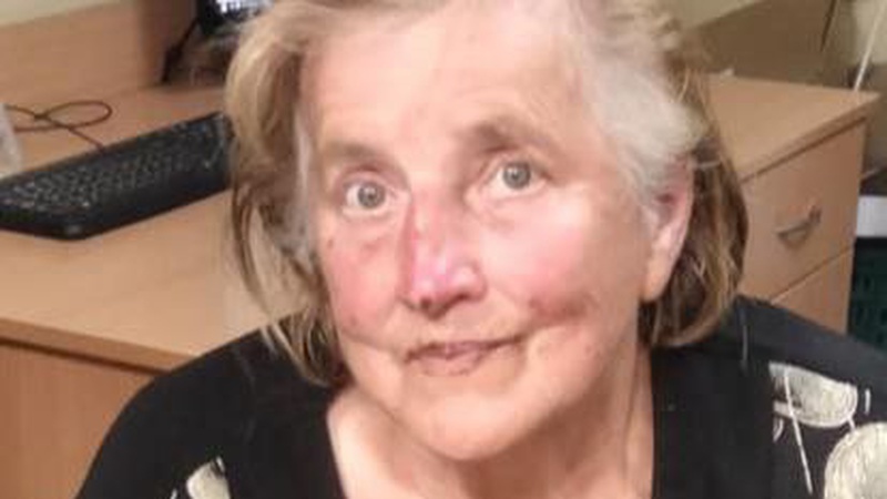 Поліція розшукує безвісти зниклу жительку Луцького району