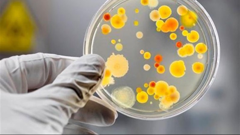 У чотирьох волинян виявили сальмонельоз: чим отруїлися