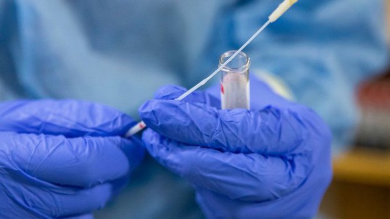 В Україні за добу – 655 нових хворих на коронавірус, на Волині – 6