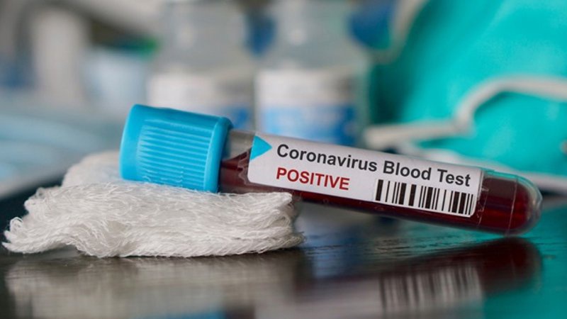 COVID-19 в Україні: за добу підтвердили 3620 нових випадків