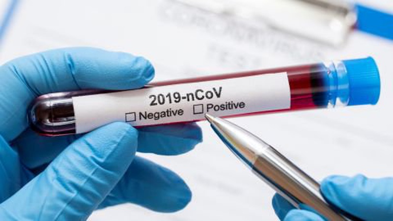 47 волинян захворіли на коронавірус