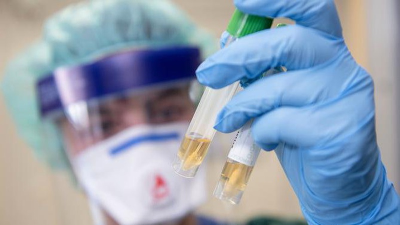 В Україні в неділю виявили 12 915 інфікувань коронавірусом, на Волині – 251