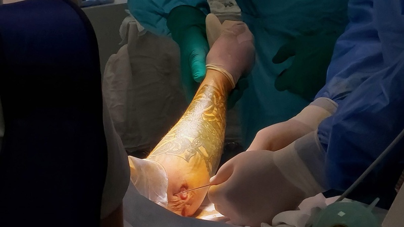 Володимирські лікарі прооперували військового з вогнепальною раною