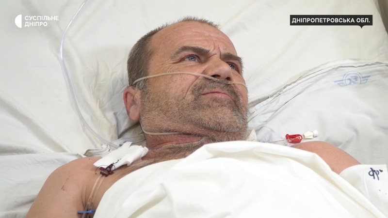 Немає обох ніг та перелито близько 5 літрів крові: історія воїна з Волині, який дивом вижив під час важкого бою