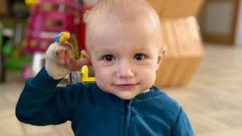 Львівські хірурги видалили однорічному хлопчику з Волині пухлину вагою 2,6 кг