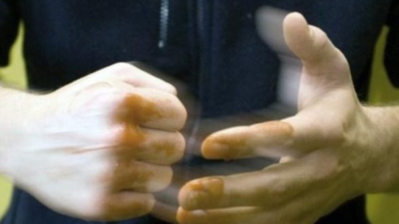 На Волині затримали хлопця, який ледь не убив неповнолітнього