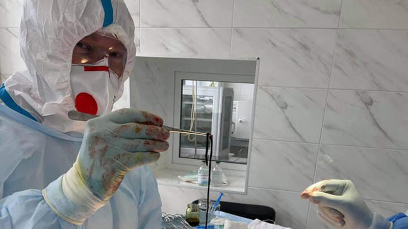 Волинські хірурги видалили з руки ковідного хворого 15-сантиметровий тромб. ФОТО 18+