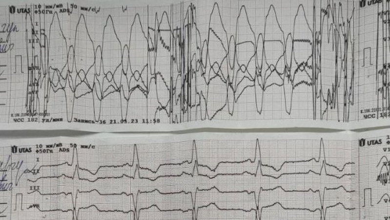 Медики «швидкої» відновили серцевий ритм 50-річному волинянину
