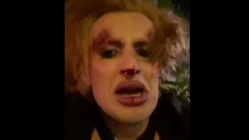 У Львові жорстоко побили трансгендерну військовослужбовицю ЗСУ