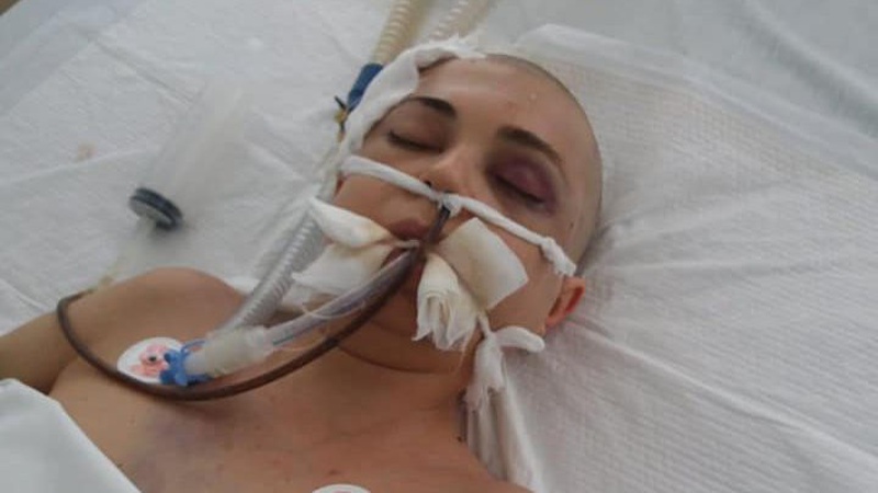 Померла 32-річна лучанка, яку жорстоко побив співмешканець