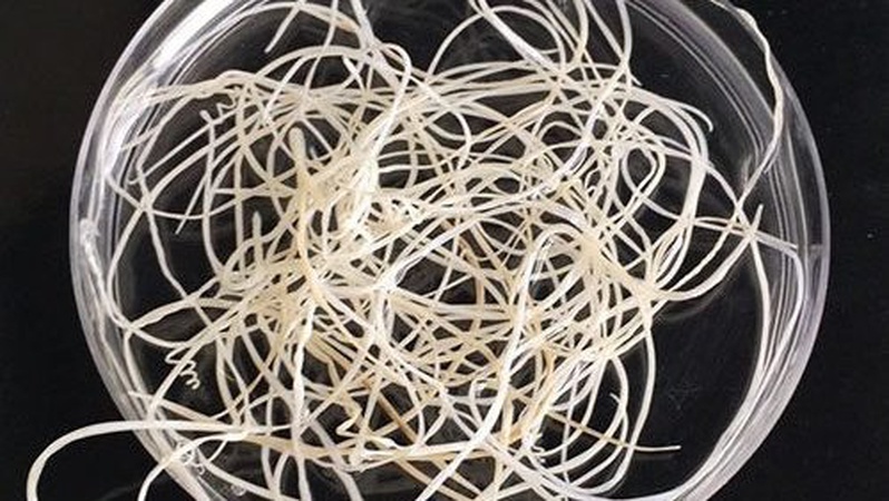 Волинянин самостійно витягнув з живота 12-сантиметрового глиста