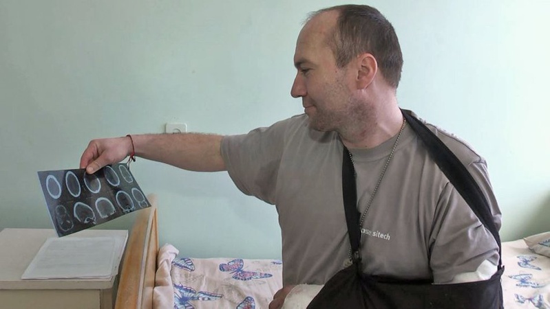 Вчитель пішов добровольцем на фронт: історія бійця, який лікується після поранення на Волині
