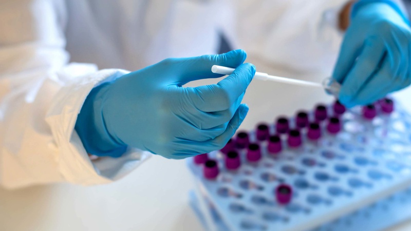 На Волині виявили найзаразніший штам коронавірусу «Дельта плюс»