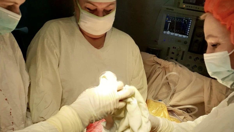 Медики видалили 40-річній волинянці шестикілограмову пухлину. ФОТО 18+