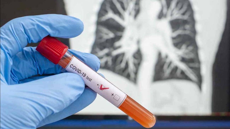 COVID-19: за останню добу на Волині 493 нових випадки і 6 смертей