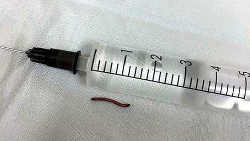 Дріт з батога застряг в оці хлопчика, його врятували луцькі медики.ФОТО 18+