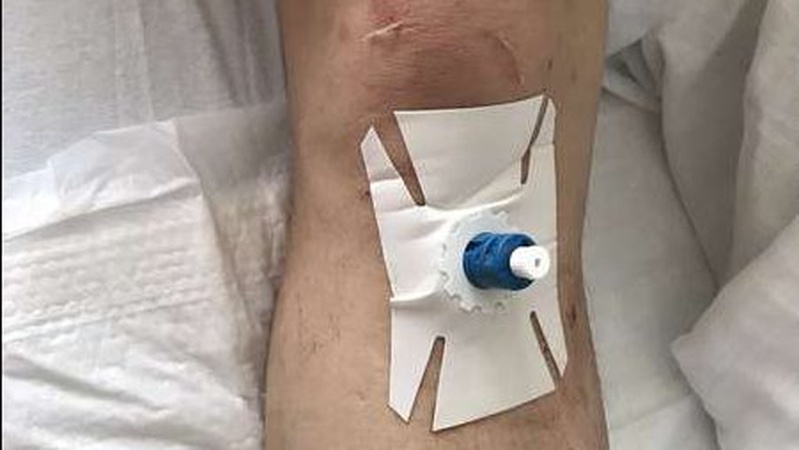 Раптова смерть: на Волині медики «швидкої» повернули до життя пацієнта. ФОТО