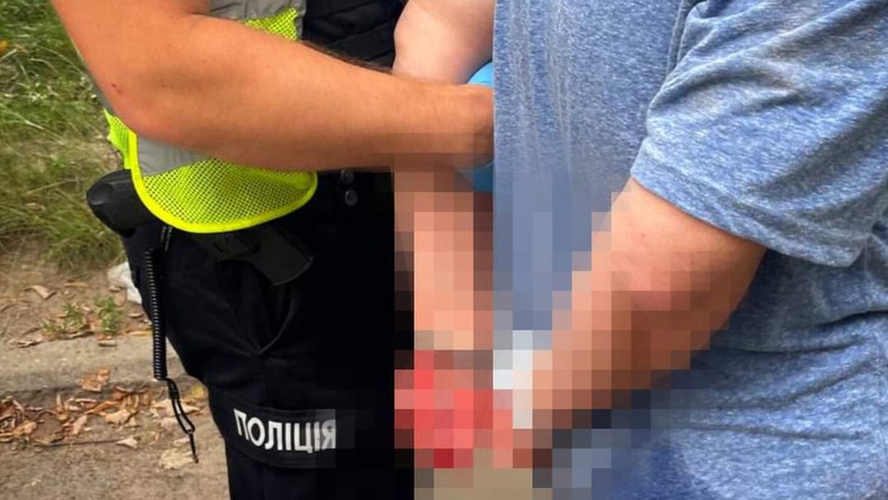 У Луцьку затримали жінку, яка кидалася на перехожих з ножами