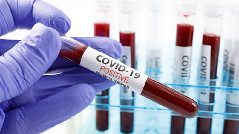 За добу в Україні виявили понад 2 тисячі випадків COVID-19