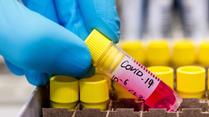 Діагноз COVID-19 за добу підтвердили у 203 волинян