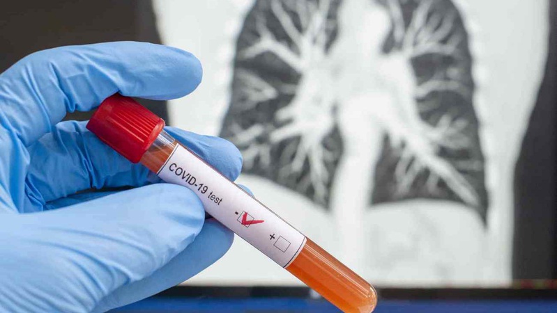 За добу COVID-19 виявили у 279 волинян: ситуація по області