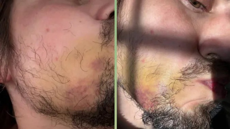 На Волині незаконно утримують і побили іноземця