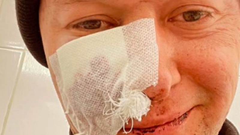 Лідер гурту «Бумбокс» отримав поранення внаслідок мінометного обстрілу