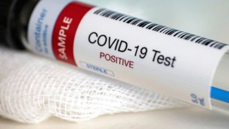 В Україні 1581 новий випадок коронавірусу, на Волині – 16