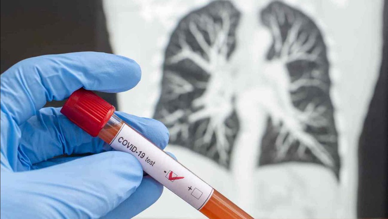 За добу 91 волинян захворіли на коронавірус