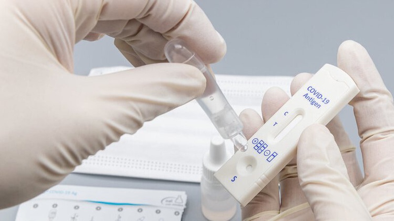 За добу в Україні зафіксували 479 нових випадків COVID-19