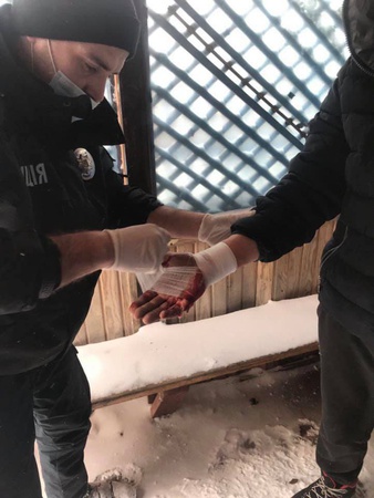 Волинянин хотів помиритися із колишньою дружиною і випадково порізав собі вени